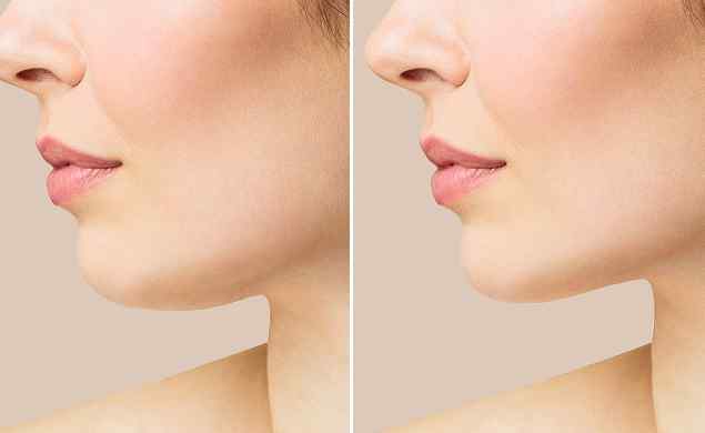 https://kartal-beauty.de/wp-content/uploads/2026/05/image_before_after_02.jpg